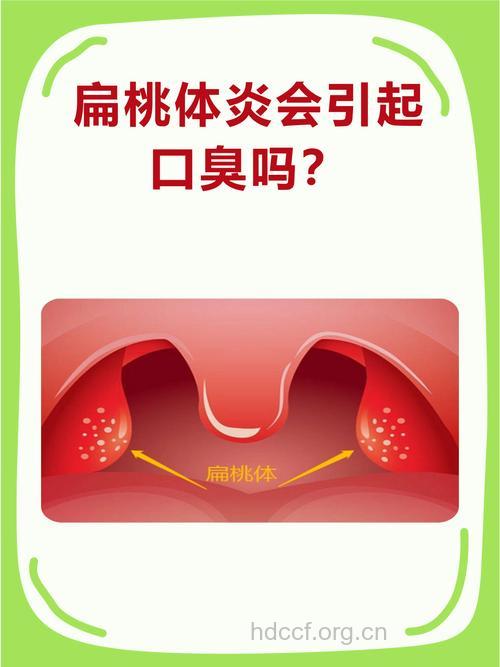 扁桃体炎也会引发口臭