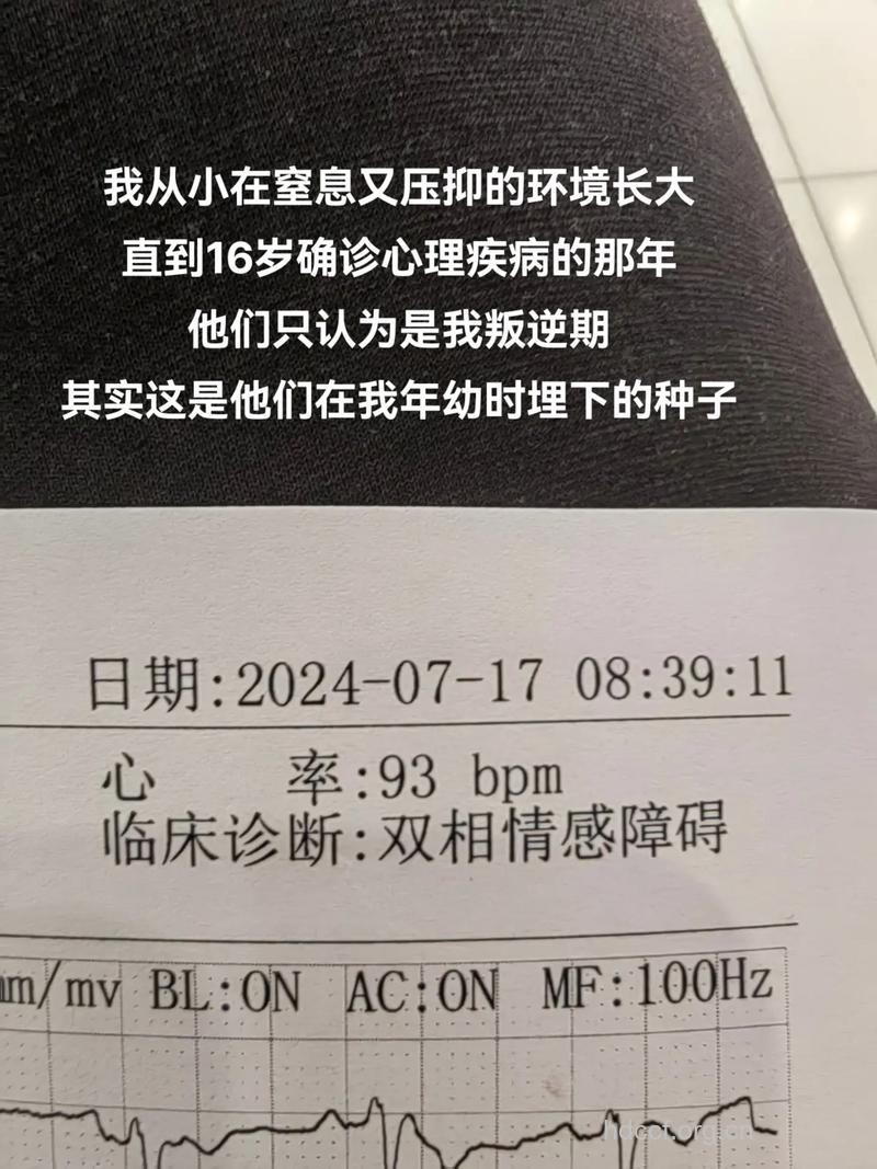 爱情妄想症病例