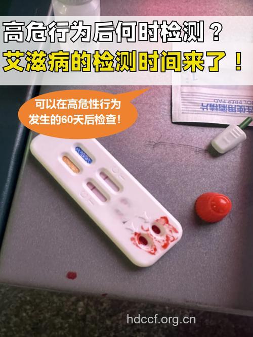 尿检可以查出艾滋病吗?