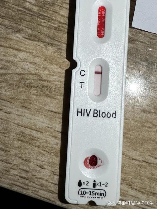 HIV抗体最低检出浓度