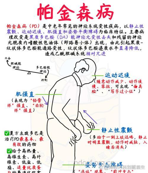帕金森病早期有哪些症状