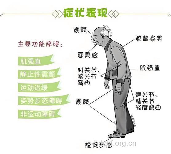 帕金森的症状表现是什么呢