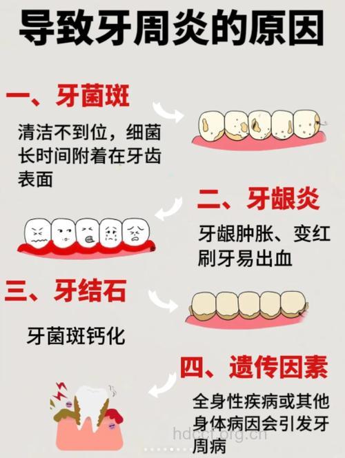 龋病和牙周病可引发口臭
