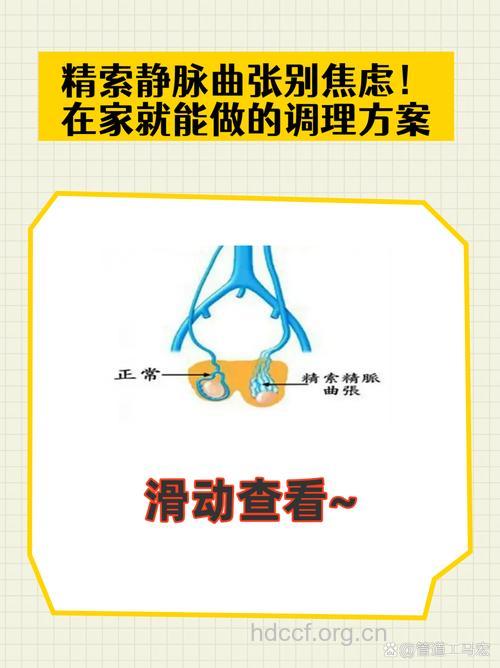 精索静脉曲张的中医分型治疗