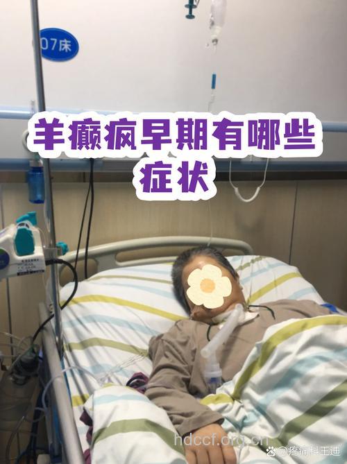轻微性羊癫疯的几种症状