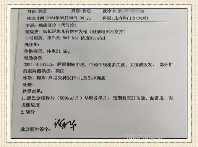 诊断羊癫疯的几个依据