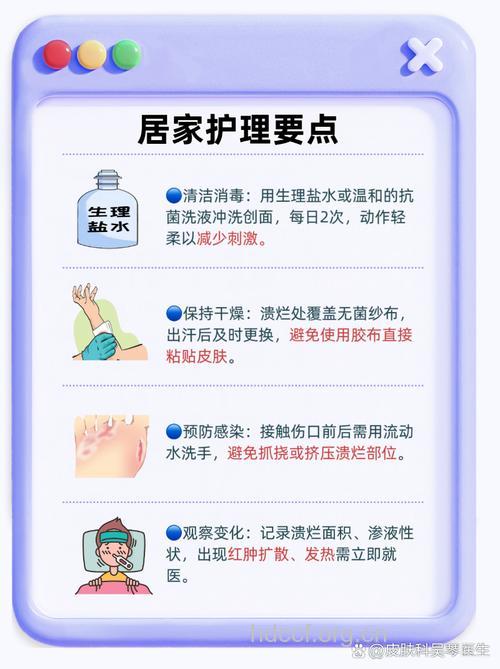艾滋病患者的日常怎么护理