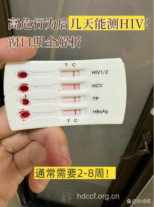 艾滋病检测试纸结果准吗