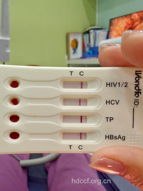 艾滋病检测试纸加几滴血