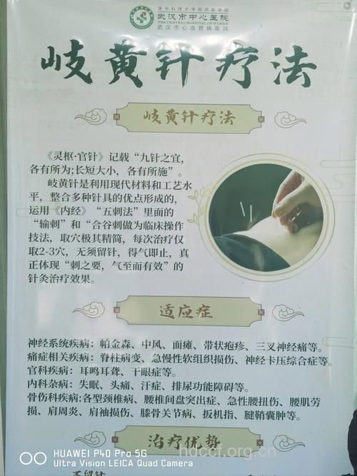 中医治艾滋 方剂+针灸