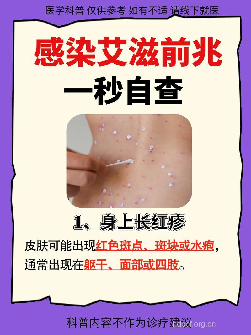 感染艾滋病该怎么办