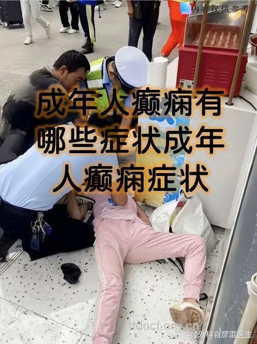 成年癫痫的早期症状是哪些