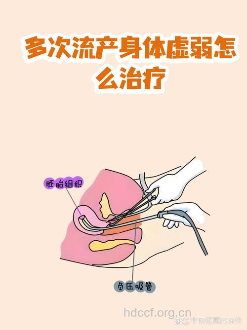 妇女反复流产心理治疗法