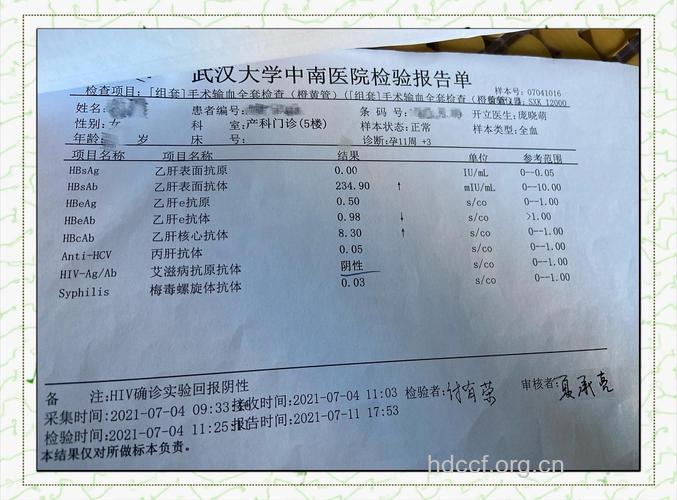 为何艾滋病病毒感染的检测结果不确定？