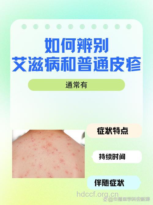 解惑:儿童得艾滋病能不能痊愈