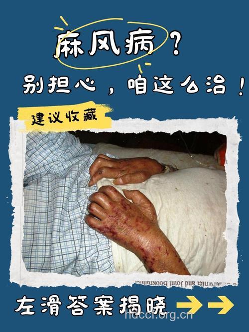 麻风病容易与哪些疾病混淆