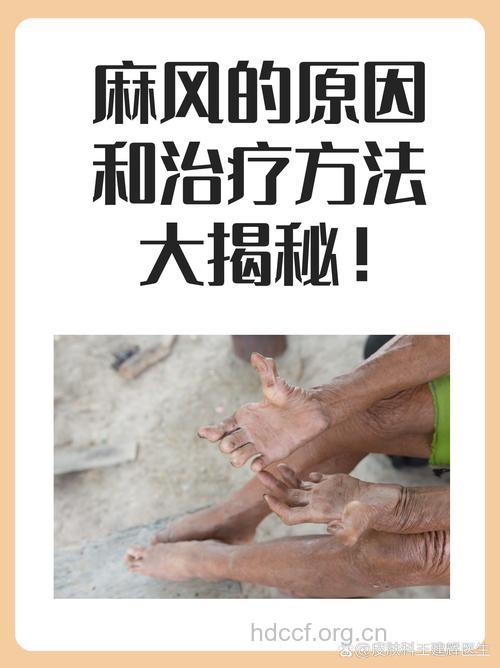 麻风病是怎么来的呢