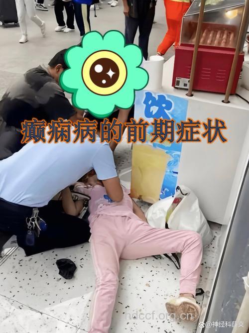 癫痫的早期症状是什么啊