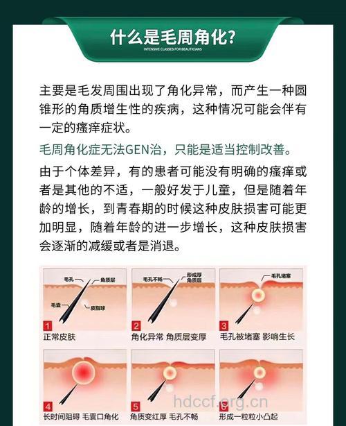 哪些药物可导致多毛 多毛的治疗