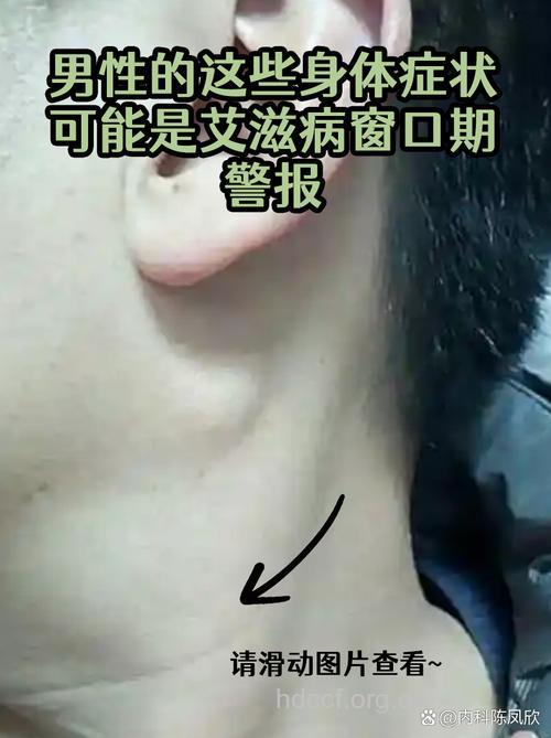 艾滋病空窗期有什么表现