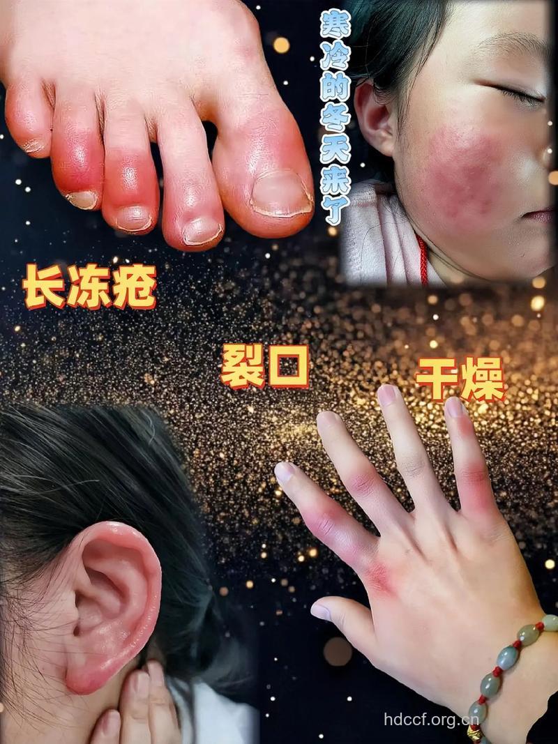 成人用儿童霜反而伤皮肤