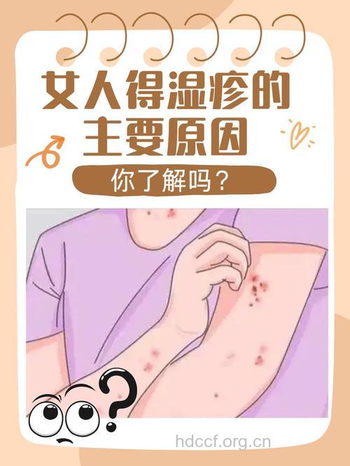皮肤病为何喜欢“纠缠”经期女性