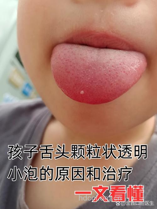 小儿口臭的症状有哪些