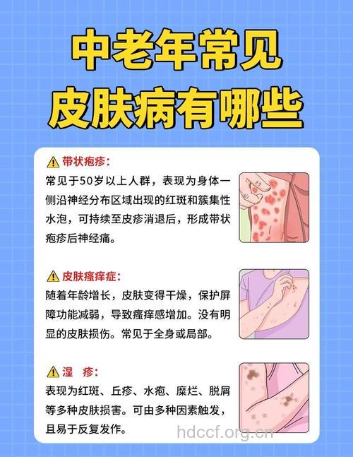 夏季老年人应谨防哪些皮肤病