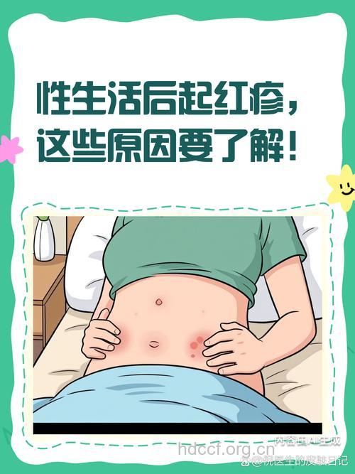 性生活为何引发女性皮肤过敏