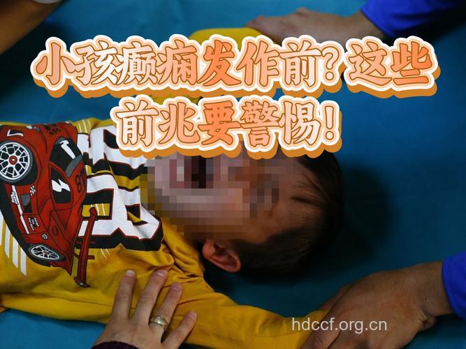 儿童良性癫痫的临床表现