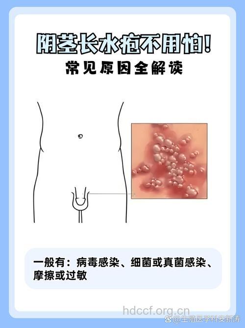 阴茎上长小水泡是什么原因