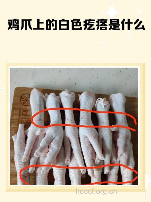 常吃鸡爪易患子宫肌瘤吗