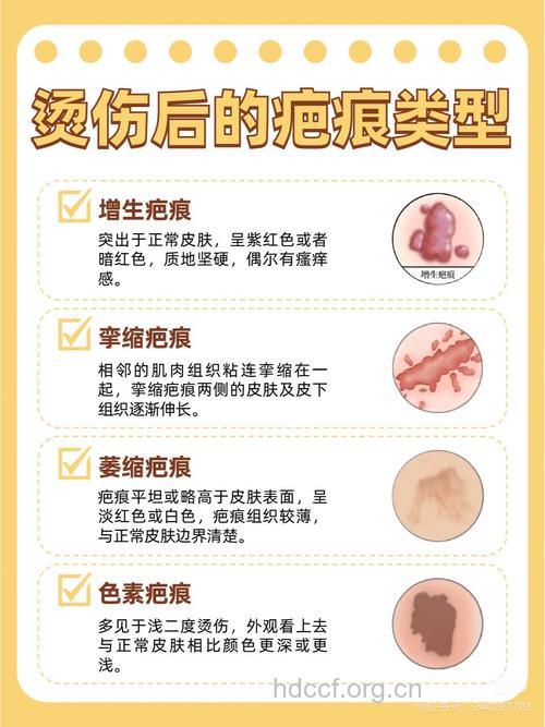 去除烫伤疤痕的最新方法