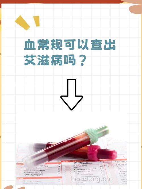 自体输血可减少艾滋病感染几率