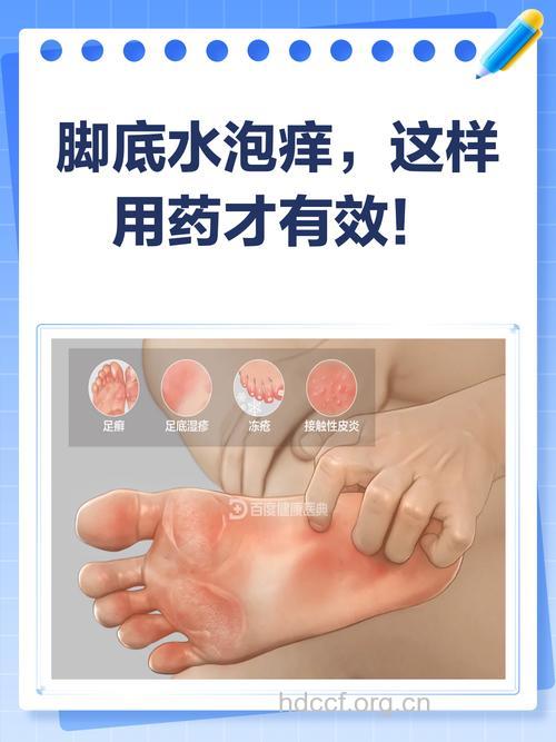 脚丫子起水泡很痒是什么原因
