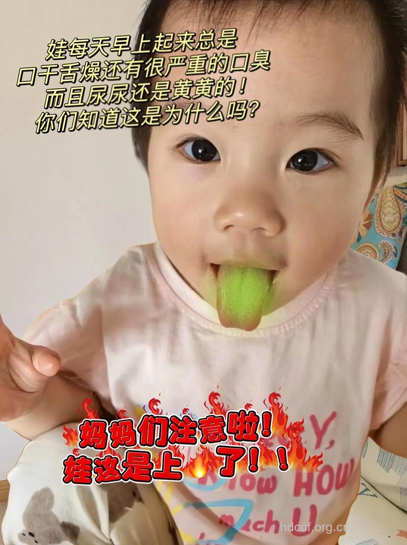 宝宝口臭的症状