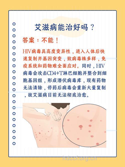 得了艾滋病能治好吗