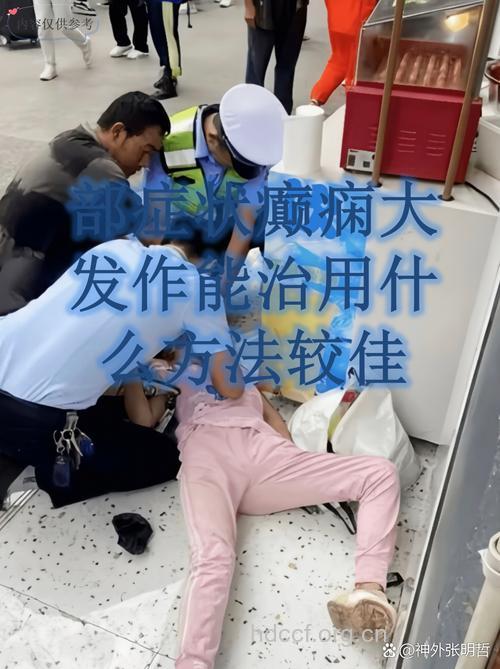 癫痫病大发作时患者会有什么表现