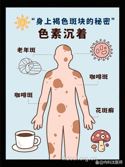 异常肤色反应身体隐藏疾病