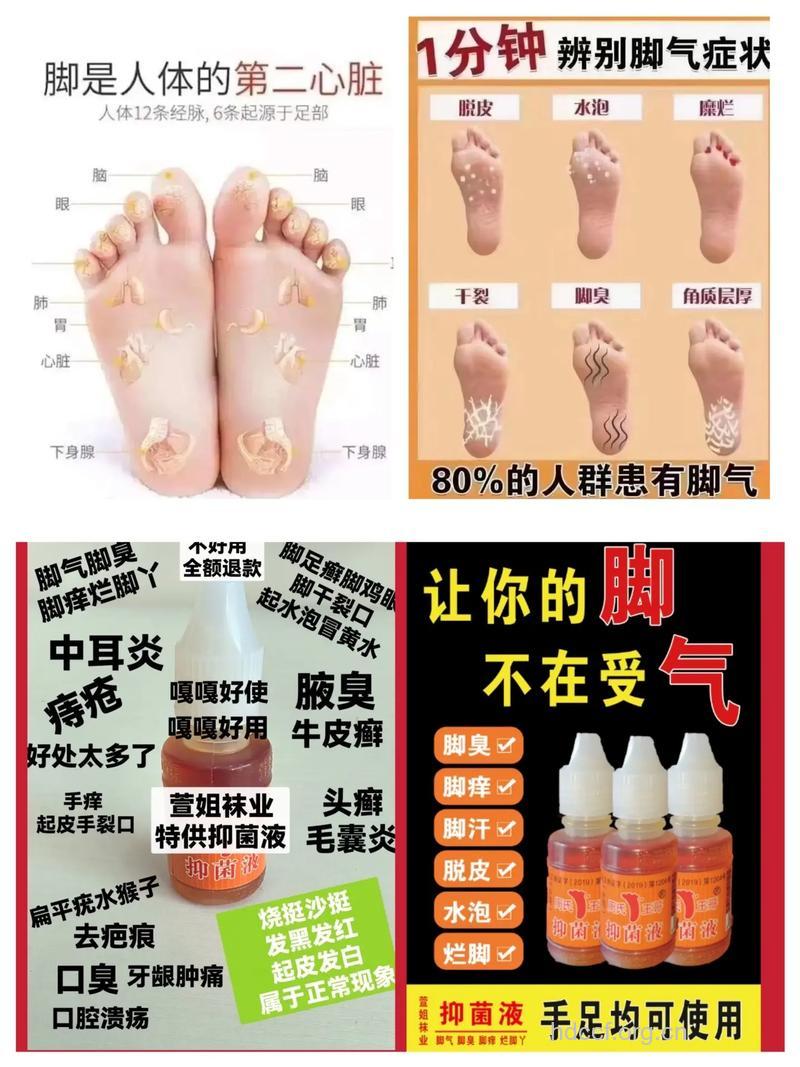 巧用风油精也可治疗脚气