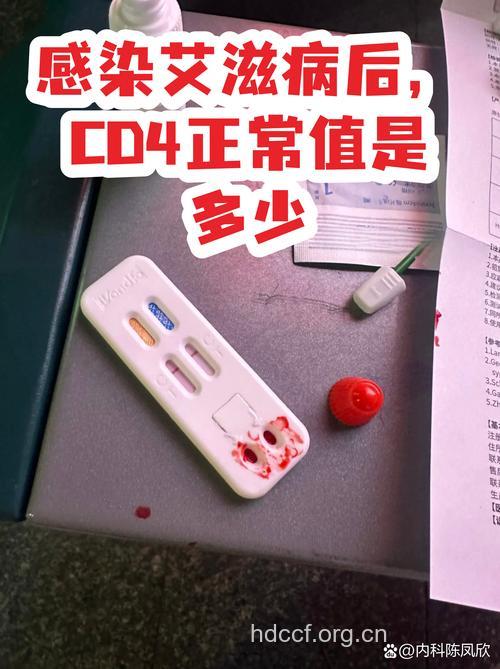 感染艾滋病后CD4多少算正常