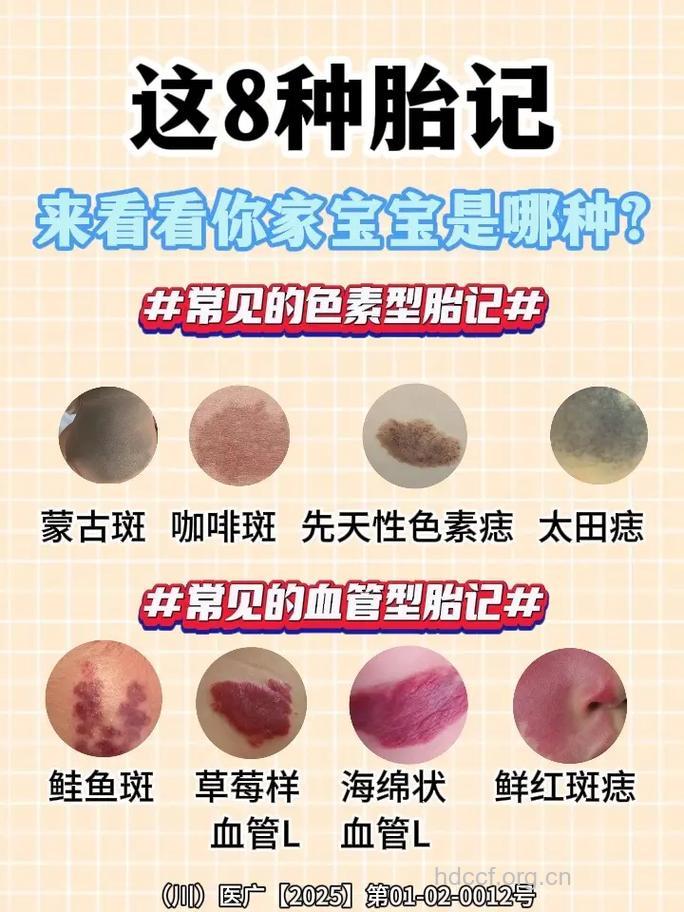 当心几种让你致命的胎记！