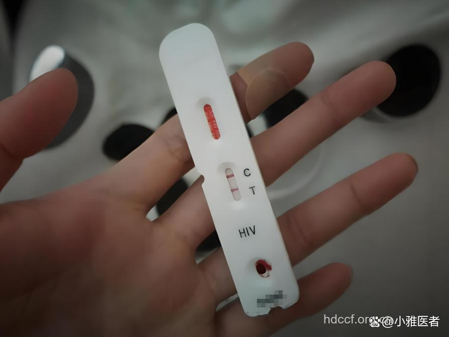 艾滋病初次检测抗体阳性 需再次检测确认