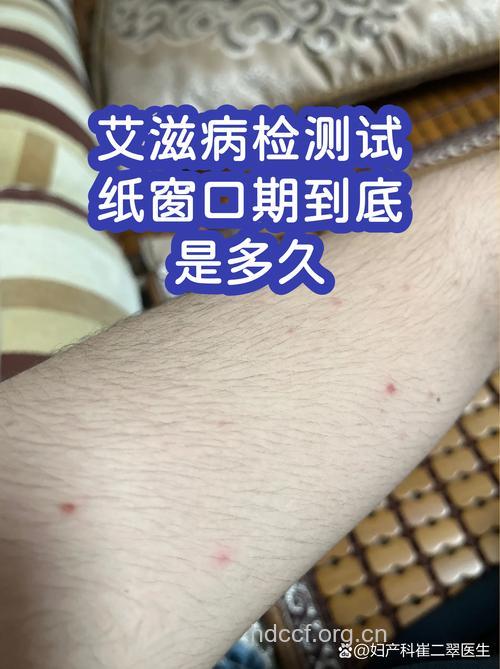 性传播的艾滋病窗口期为4周