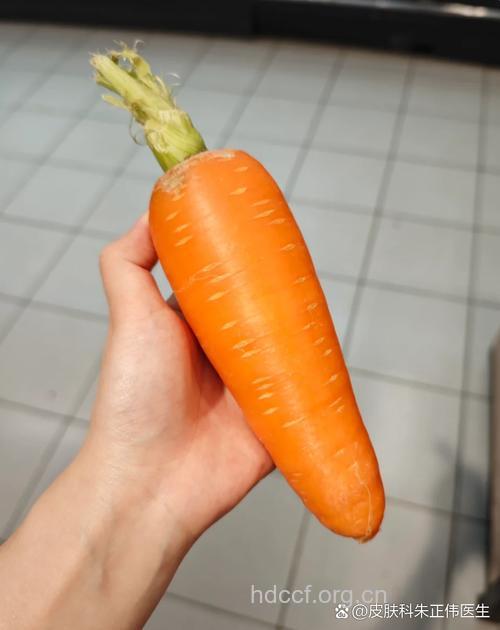 秋季皮肤干燥多吃胡萝卜