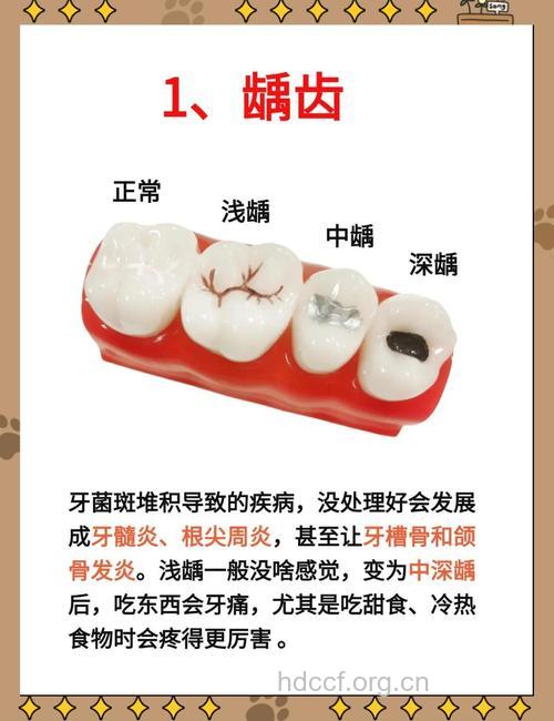 看看牙痛有哪些类型