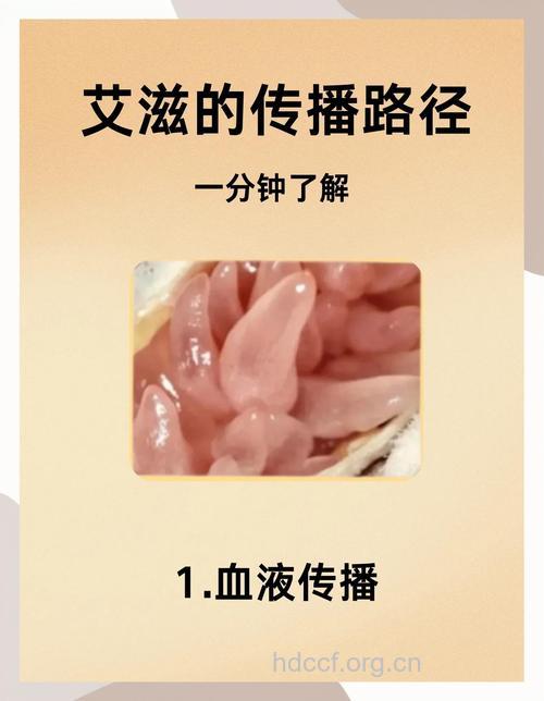 20%青年不知道艾滋病会通过性传播