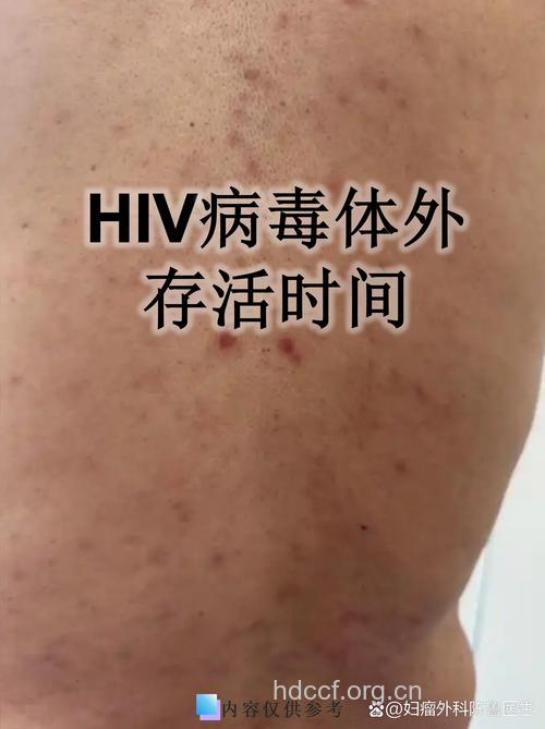 艾滋病病毒的存活能力有多强