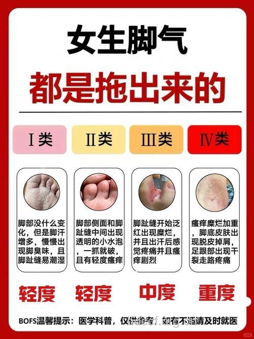 脚气治疗的4大误区要注意