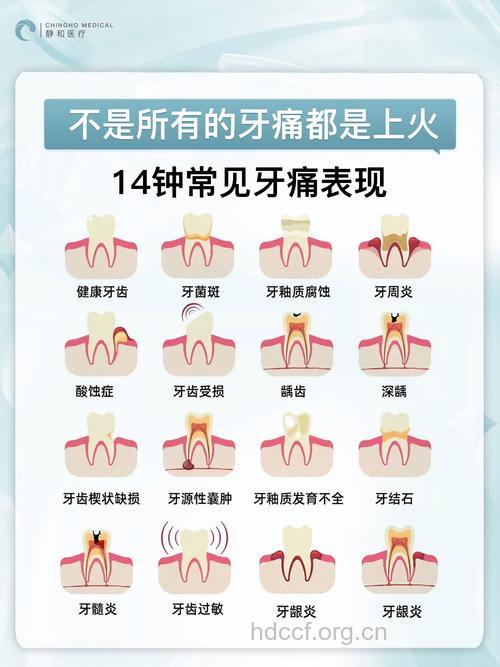 牙痛的症状表现有哪些